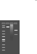 Agarose Gel