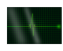 Electrocardiograms