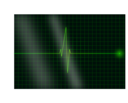 Electrocardiograms
