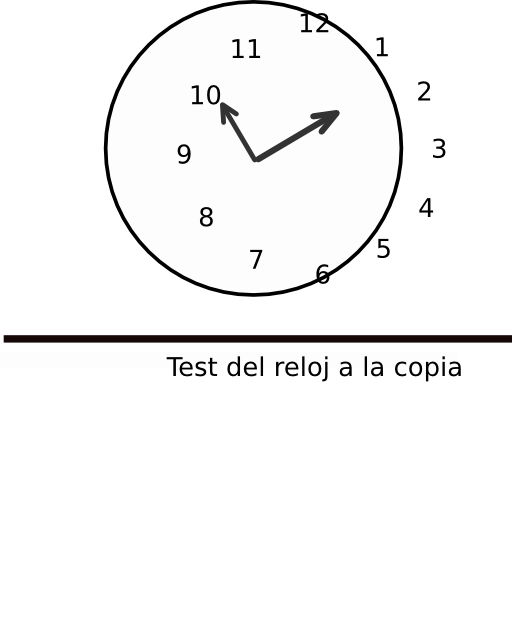 Test Del Reloj A La Copia