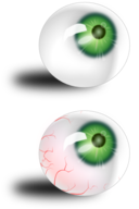 Eyeball Green Bloodshot
