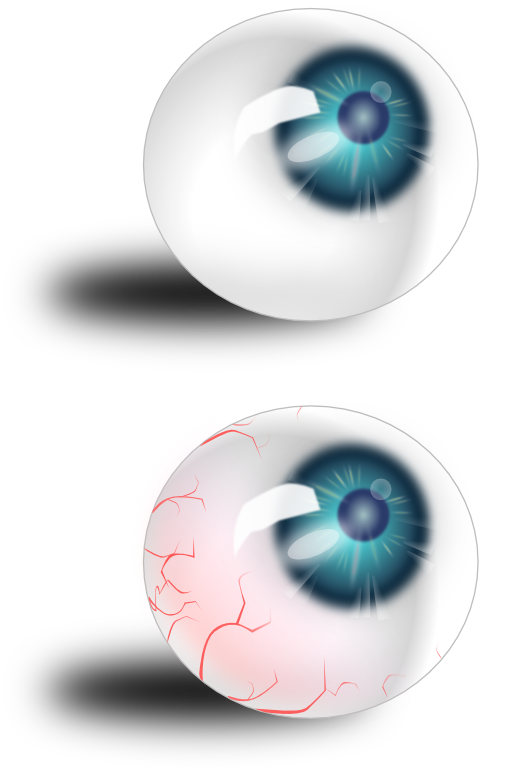 Eyeball Blue Bloodshot