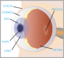 Eye With Labels
