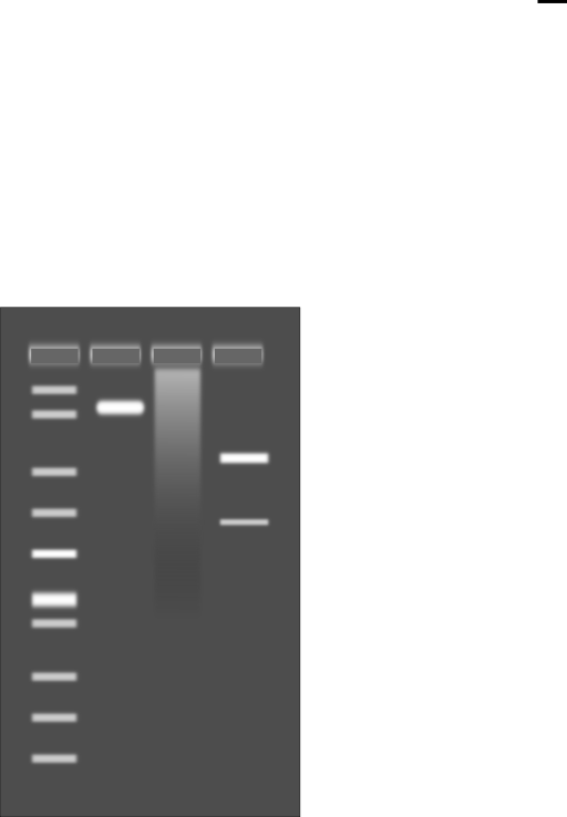 Agarose Gel