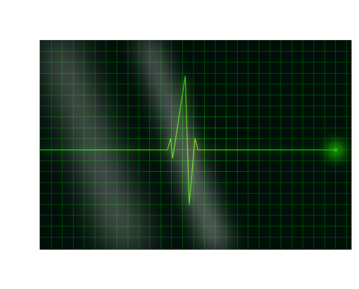 Electrocardiograms