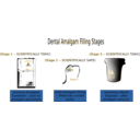 download Dental Amalgam Filling Stages clipart image with 45 hue color