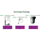 download Dental Amalgam Filling Stages clipart image with 135 hue color