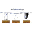 download Dental Amalgam Filling Stages clipart image with 225 hue color