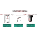 Dental Amalgam Filling Stages