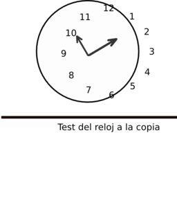 Test Del Reloj A La Copia