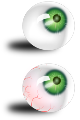 Eyeball Green Bloodshot