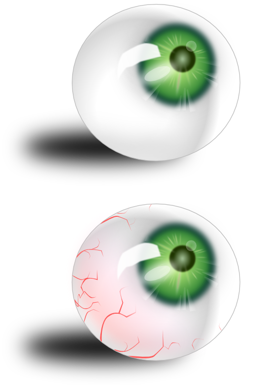 Eyeball Green Bloodshot