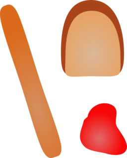 Frankfurter