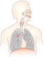 Cancer Caused By Smoking I